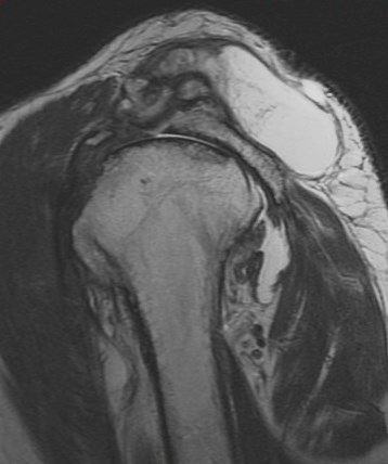 Figure 5 for case Geyser phenomenon